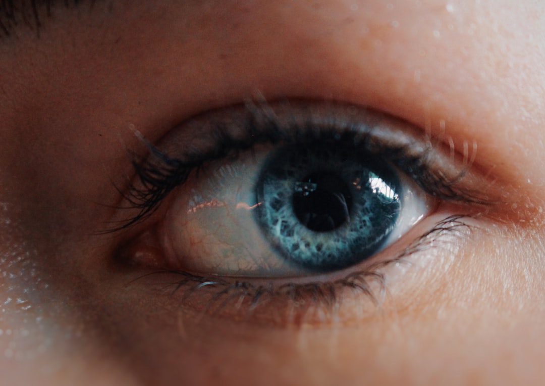 EMDR